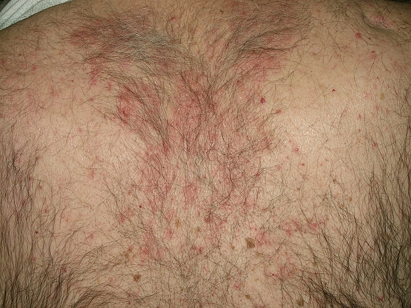 Dermatoweb.net