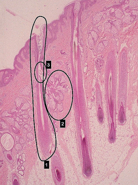 histología del folículo piloso