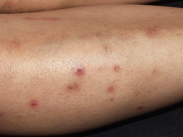 dermatoweb.net